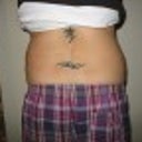 Before smart lipo - back